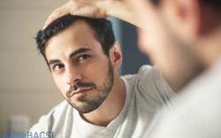 Hormone DHT: Nguyên nhân hói đầu ở nam giới